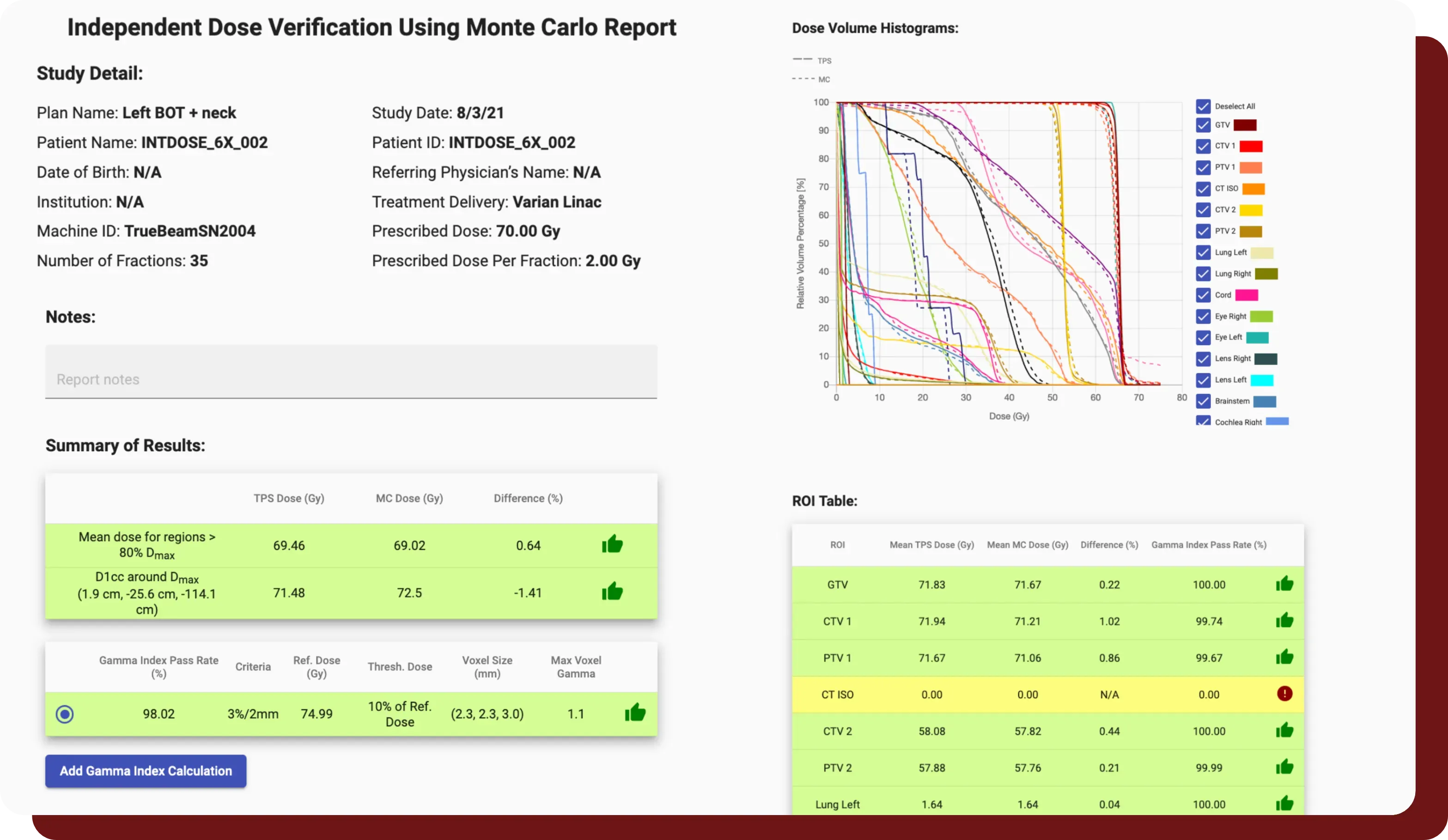INTDose Monte Carlo dose-verification report with DVH and isodose overlay