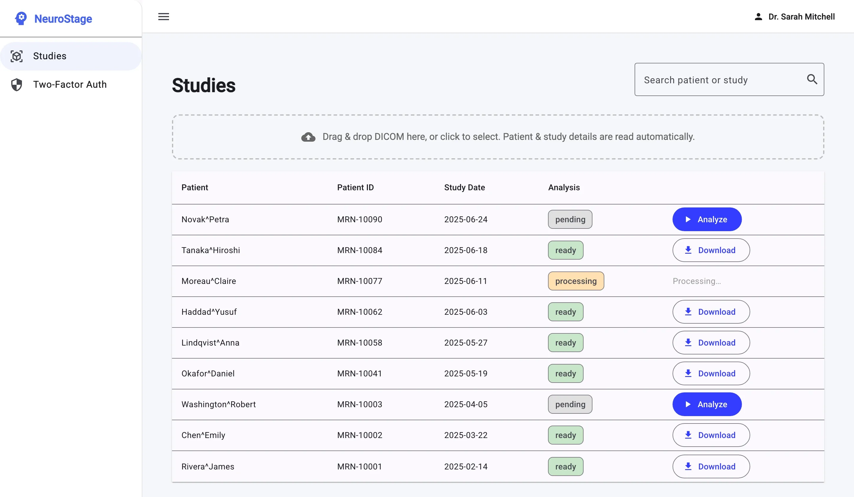 NeuroStage web study list — searchable table of studies with patient, ID, study date, and per-study analysis status, plus a drag-and-drop DICOM upload zone