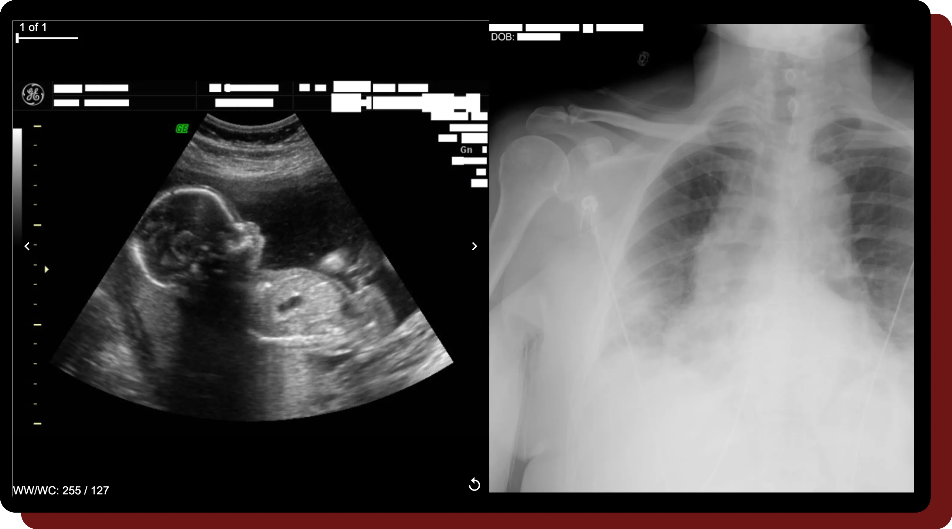 2 different medical images that have burned-in text omitted from them.