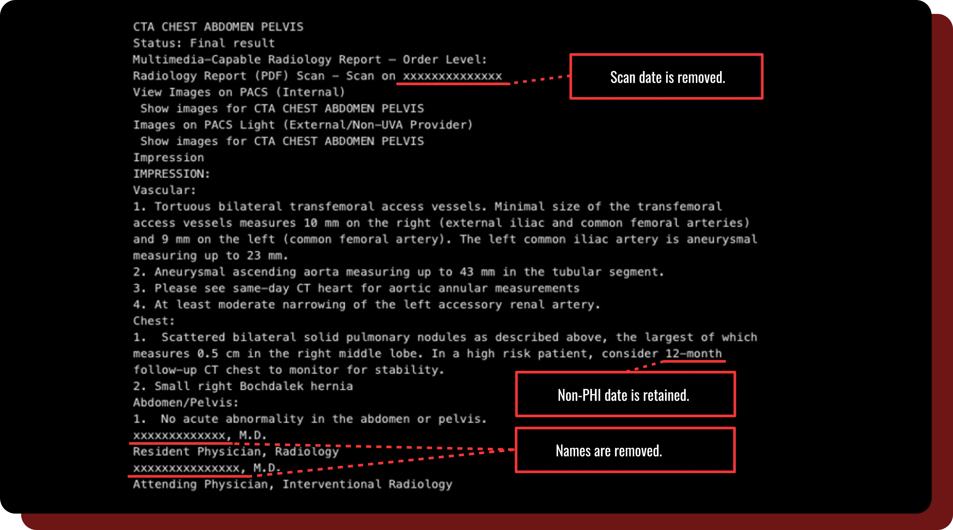 A report that has essential PHI removed, and shows highlights of how DeIdentifier interprets data.