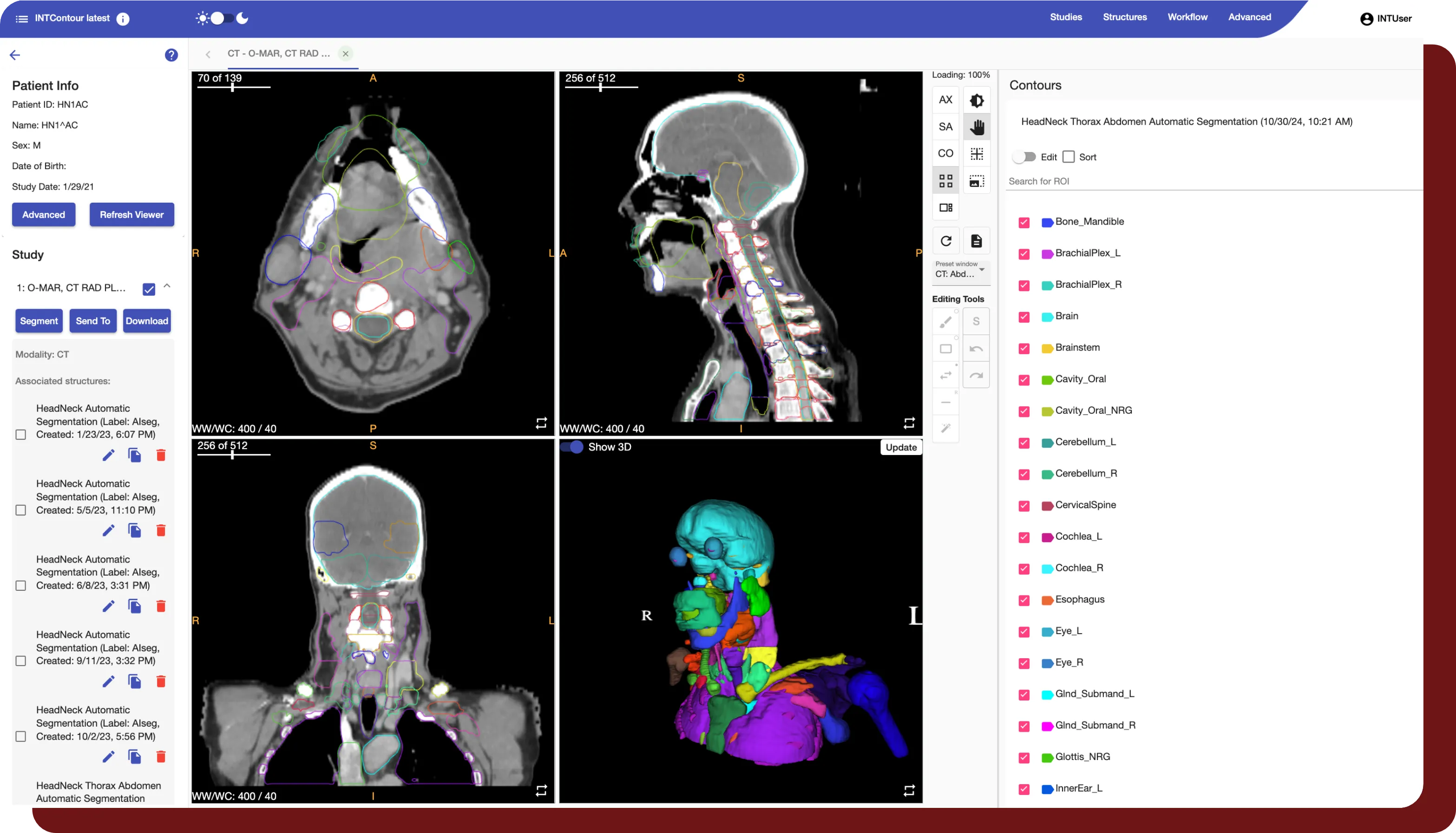 An example of INTContour's built-in viewer with automated segmentations visible. 