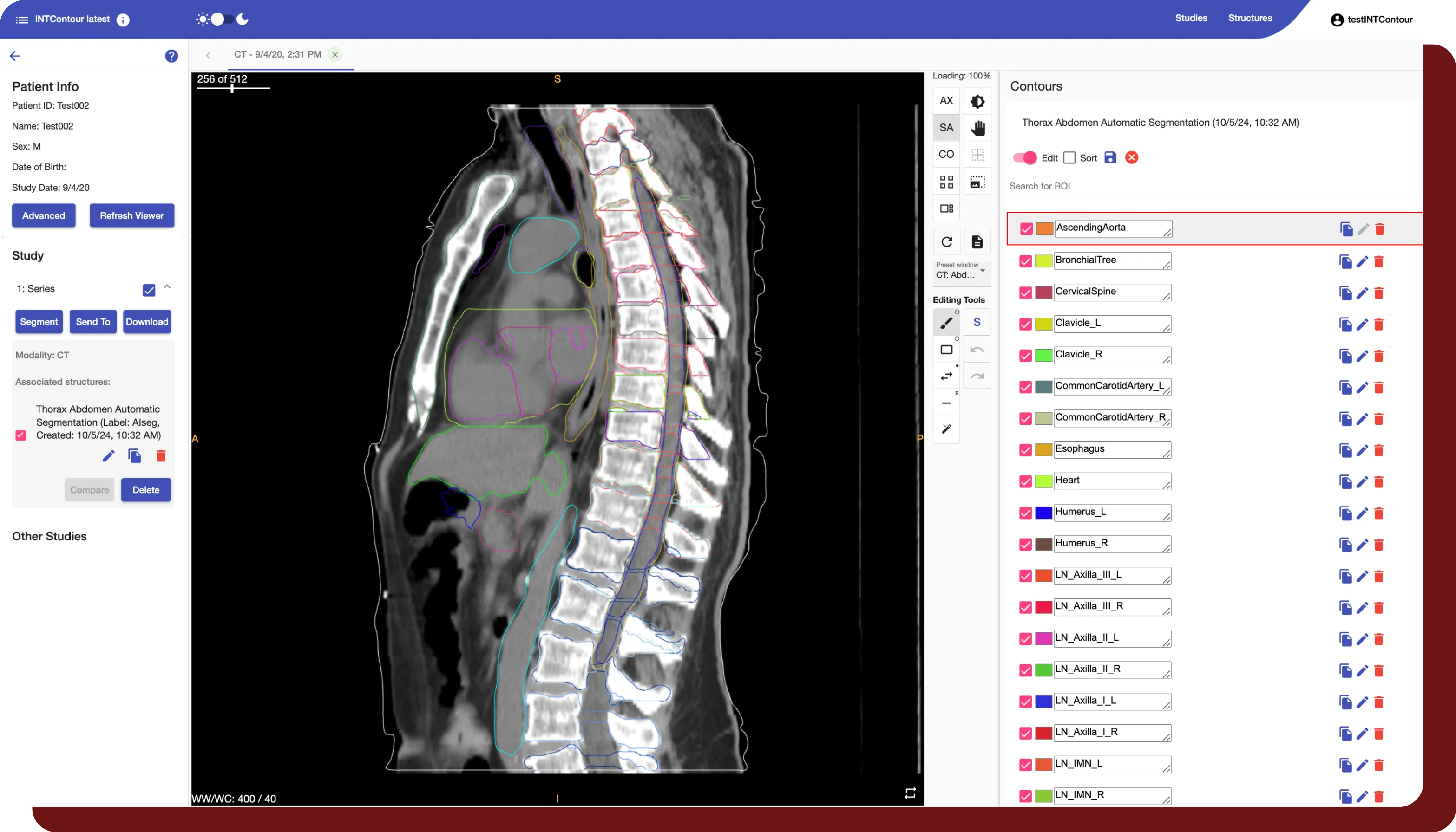 An example of the ROI editing feature available within INTContour's built-in viewer. 