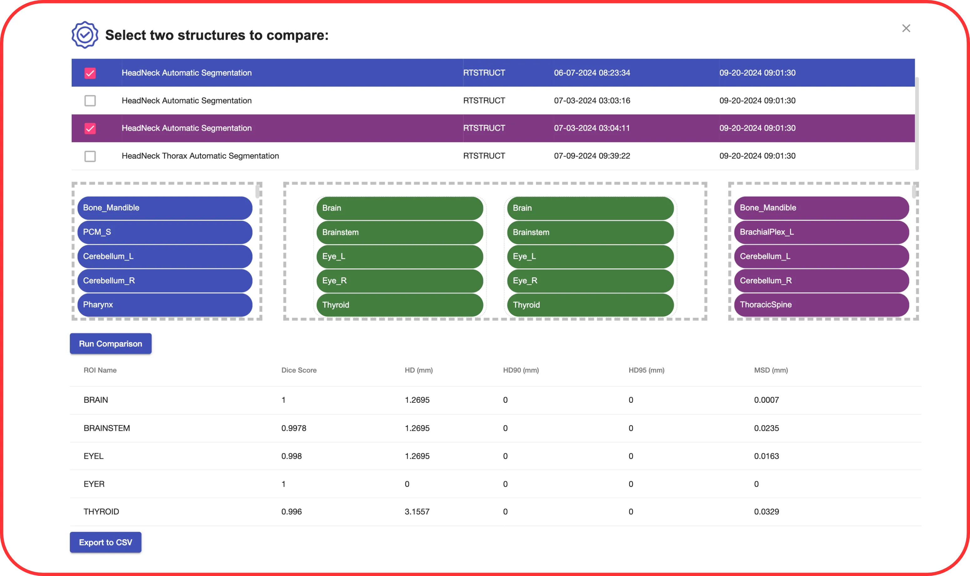 An example of INTContour's user interface for running a quality assurance check on certain segmentations within a series.