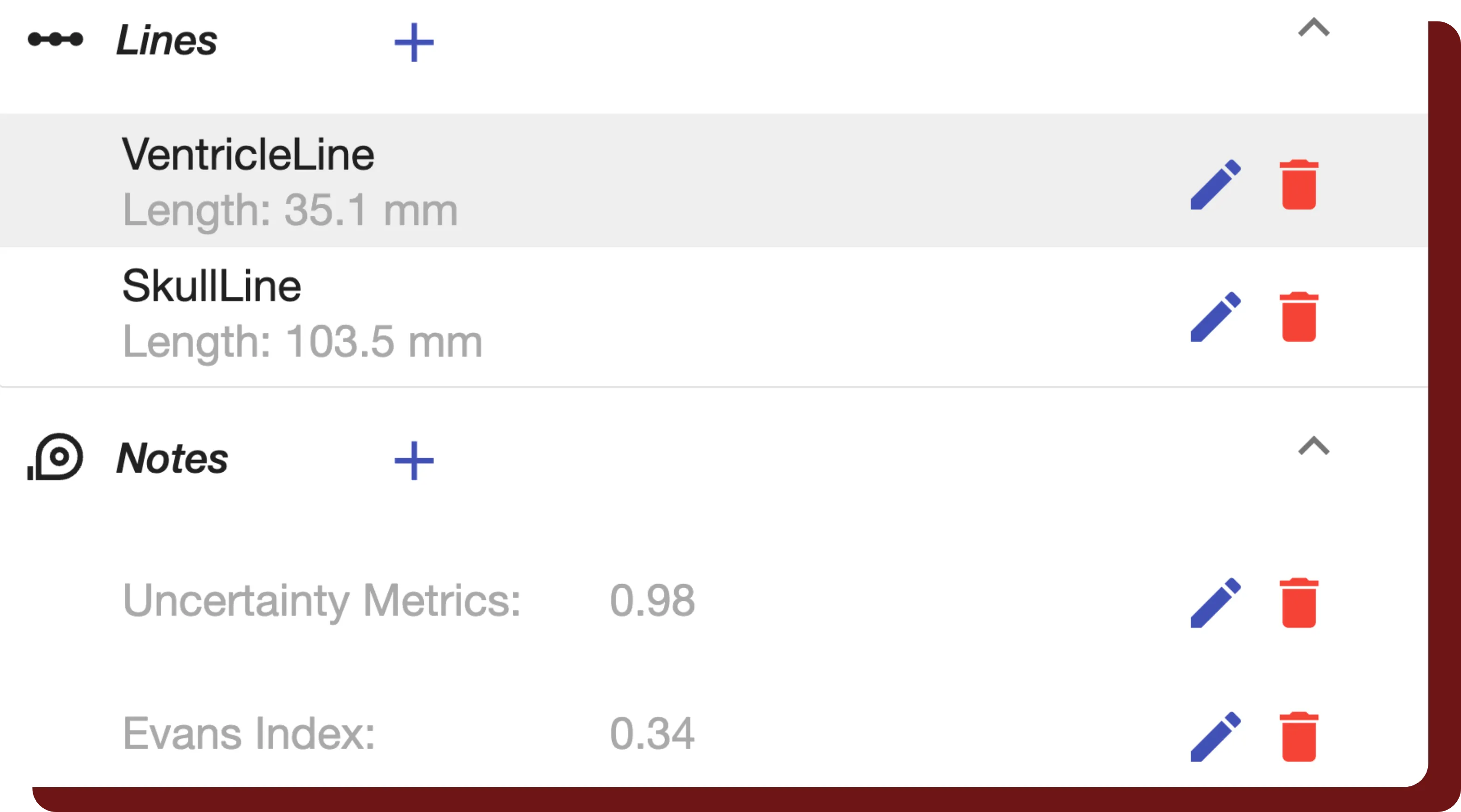 Quantitative results from automated segmentations completed within QuantBrain - Ventricle. 