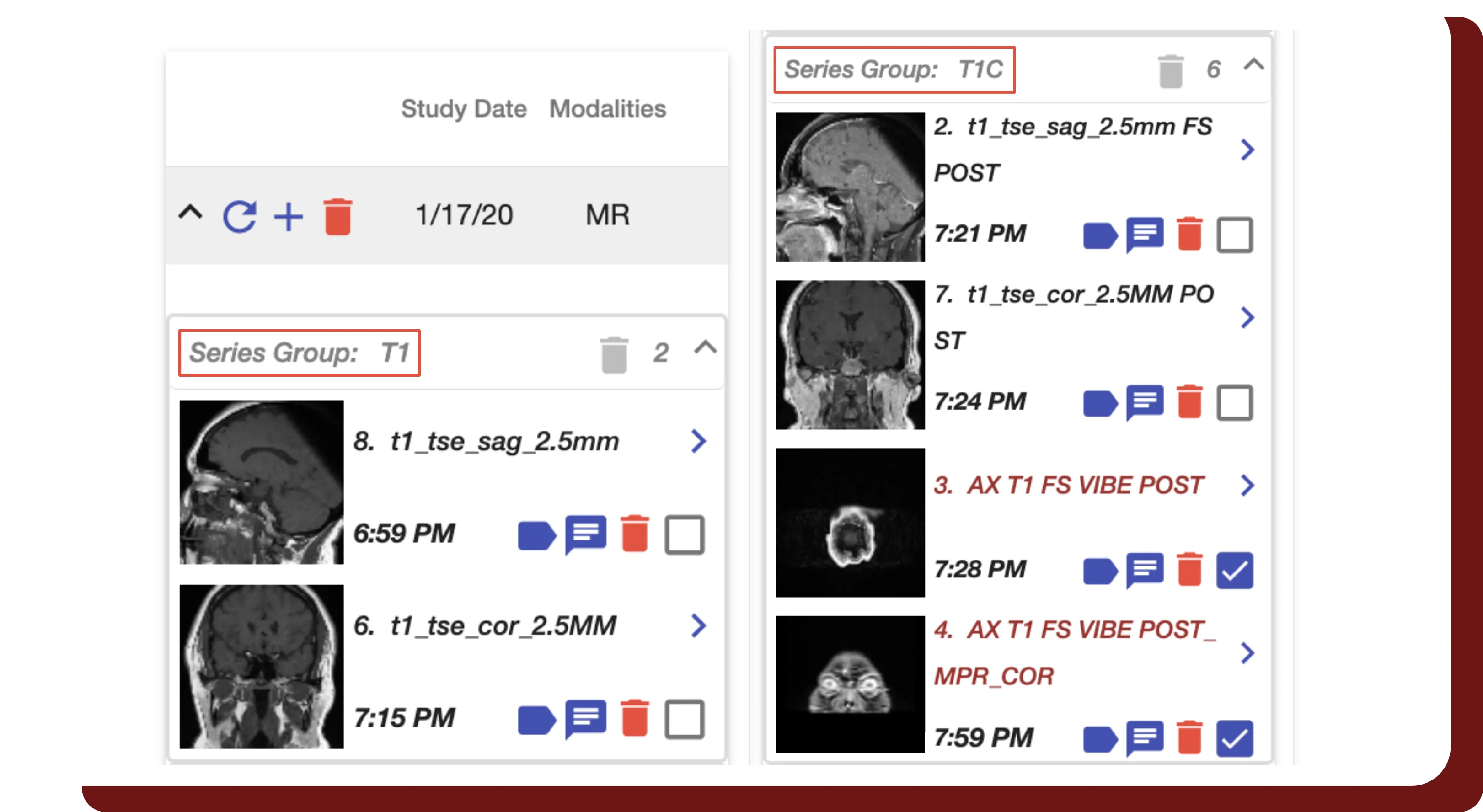 An example study that has had its series parsed, and sorted into groups.