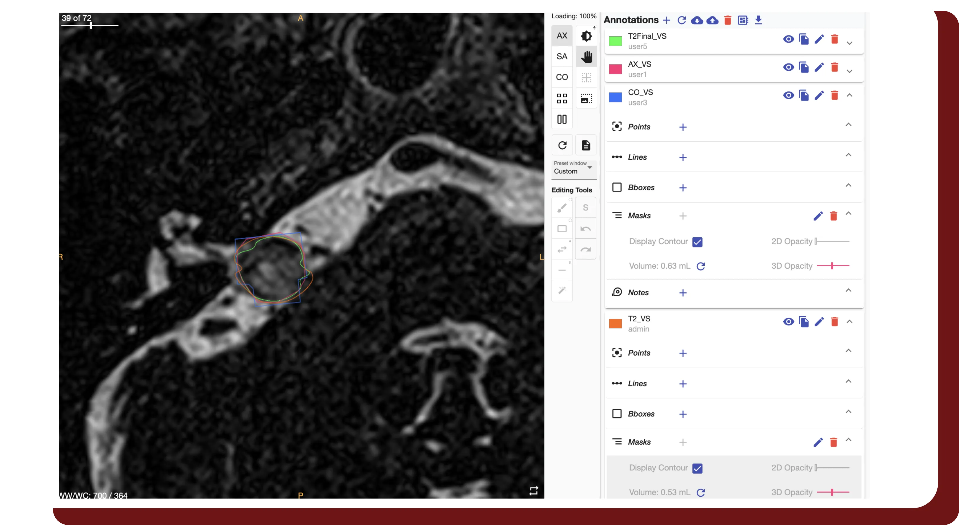 An image of DeIdentifier's user interface, showing annotations on a series from multiple users.